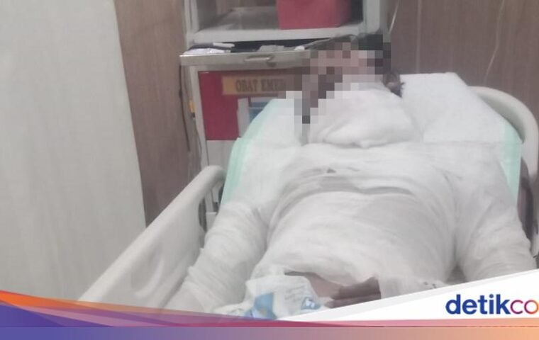 Sopir di Bali Dibakar Bos, Luka Parah dan Tak Bisa Bayar Perawatan