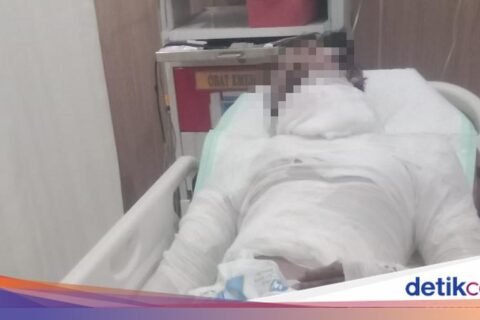 Sopir Truk yang Dibakar Bos di Bali Meninggal Dunia